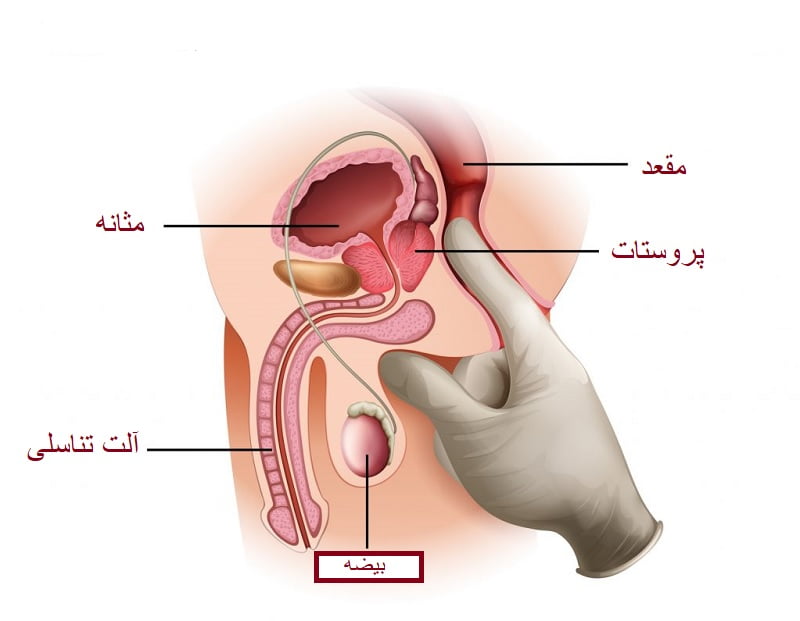 ماساژ پروستات