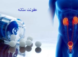 علت درد مثانه بعد از ادرار
