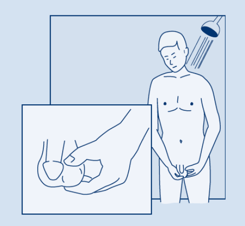 معاینه بیضه