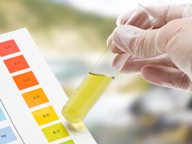 خون در ادرار