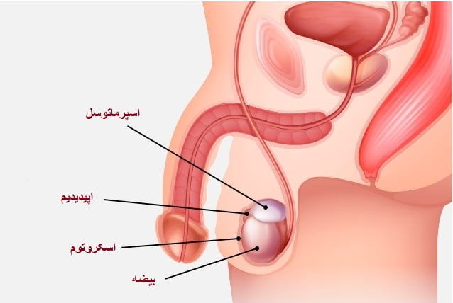 درمان قطعی کیست بیضه