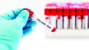 آزمایش urea