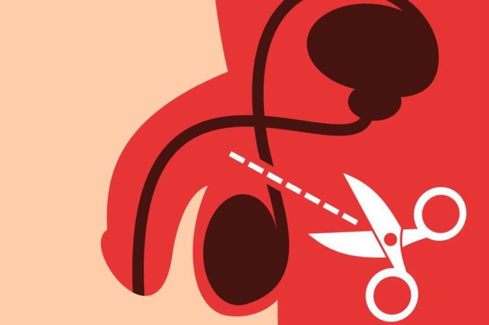 هزینه بستن لوله در مردان