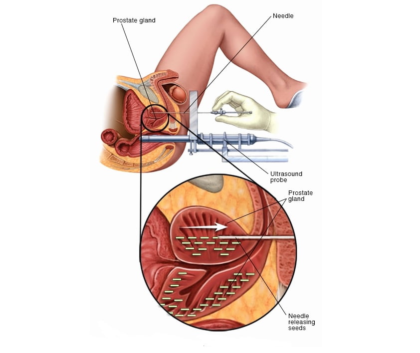 درمان بیولوژِی