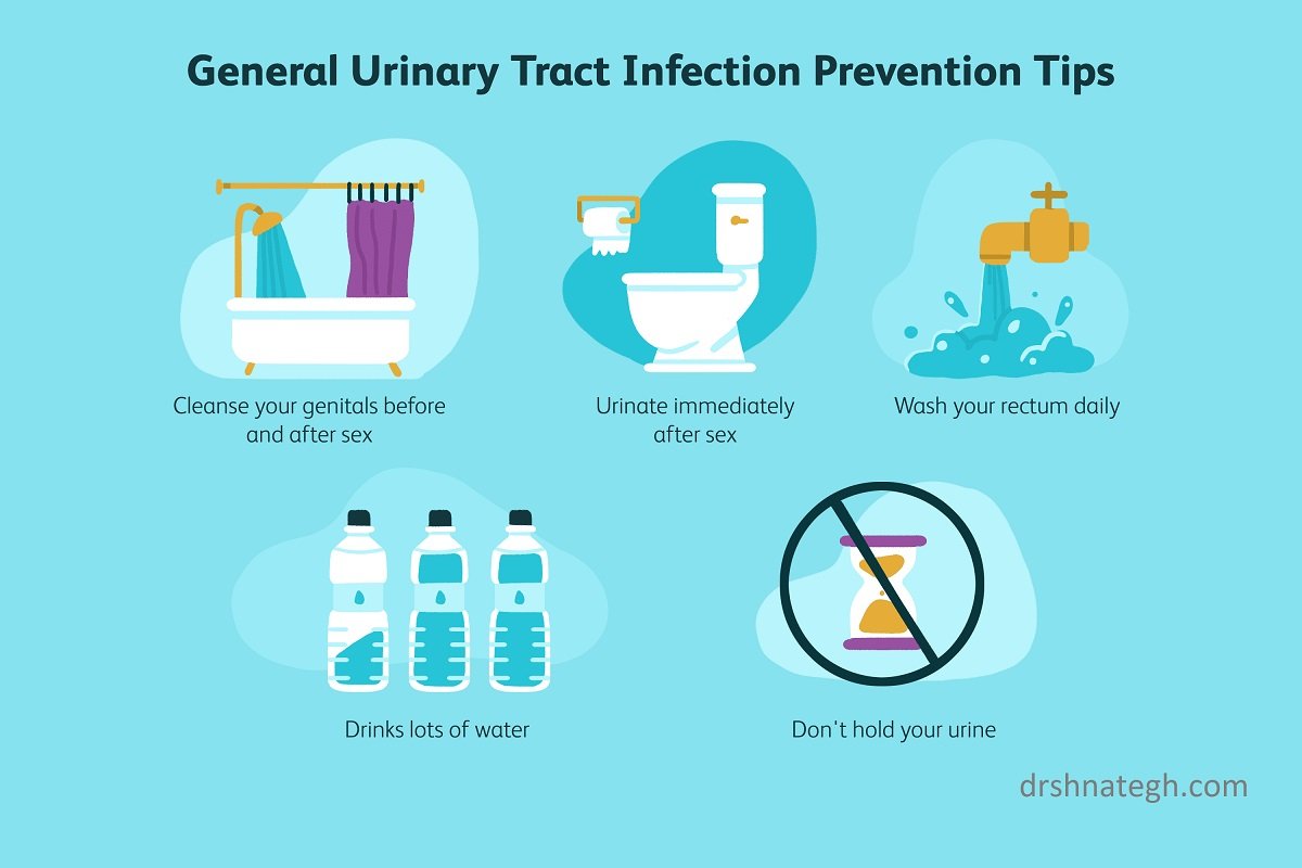 پیشگیری از عفونت ادراری در زنان