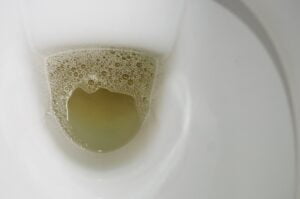 كف كردن ادرار