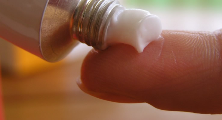 Topical treatment for genital warts