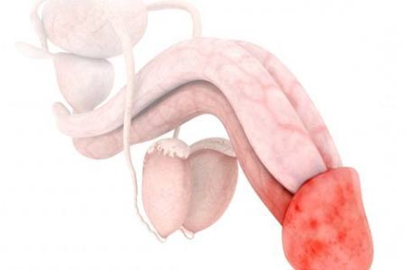عکس ترک پوست در ناحیه تناسلی مردان