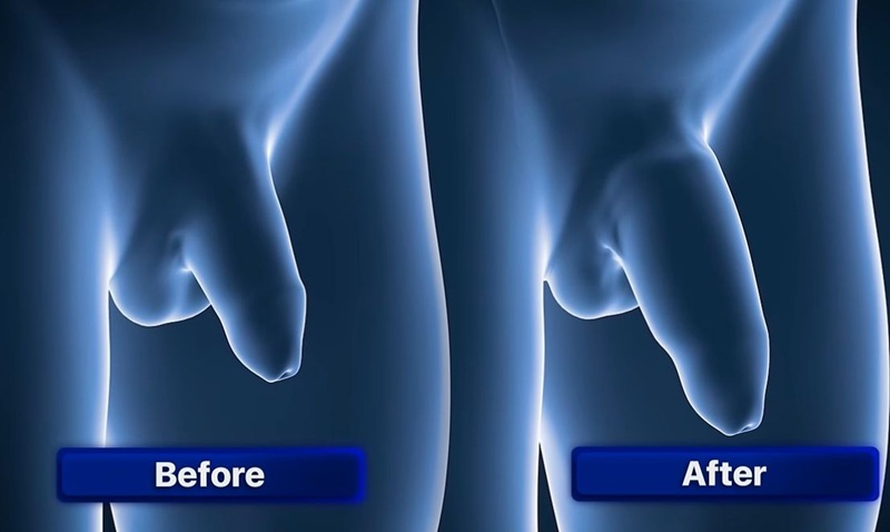 بزرگ کردن الت